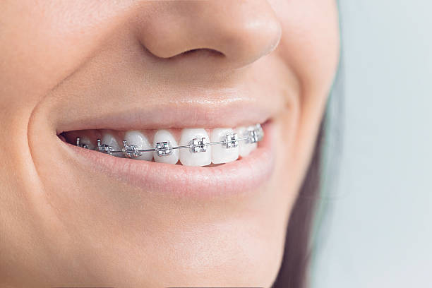 Best Dental Inlays and Onlays  in Fort Irwin, CA